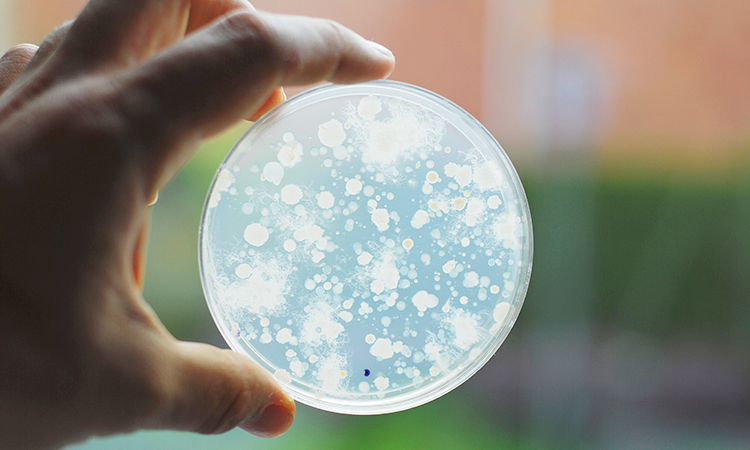 Microbiome in a petri dish being held near a window
